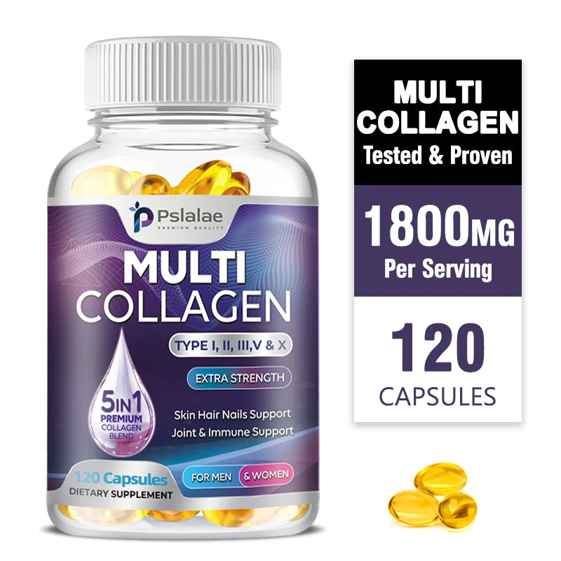 Collagen Complex - Types I, II, III, V, and X