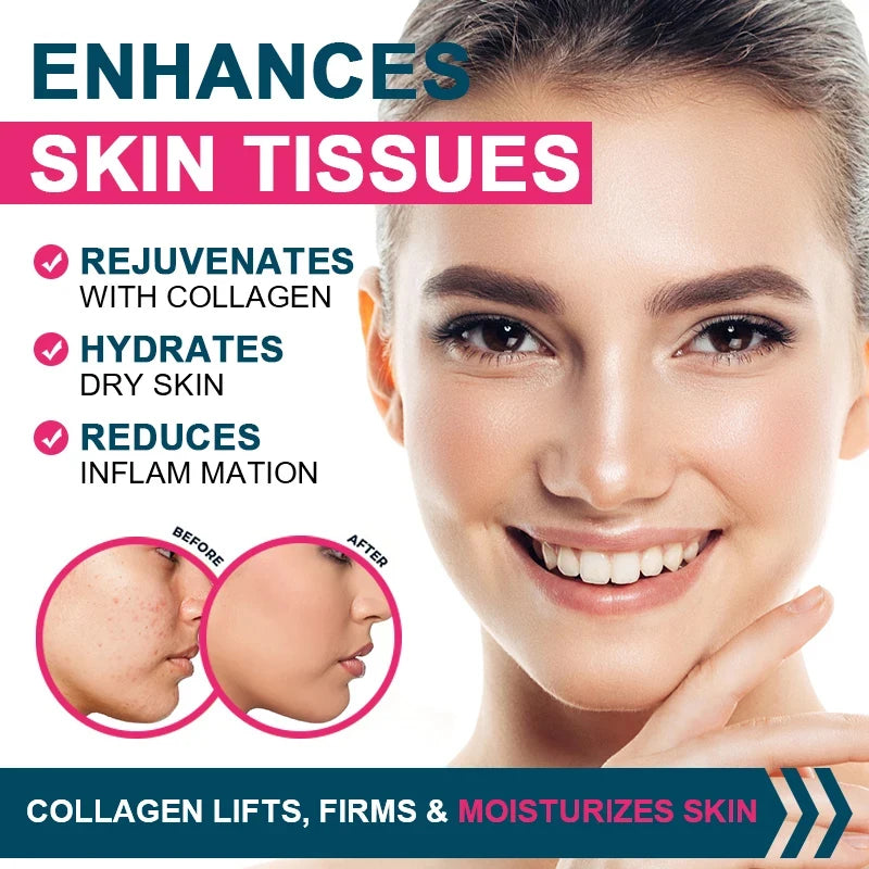 Collagen Complex - Types I, II, III, V, and X