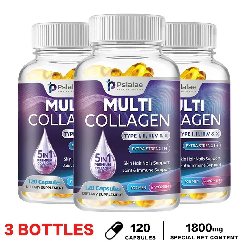 Collagen Complex - Types I, II, III, V, and X